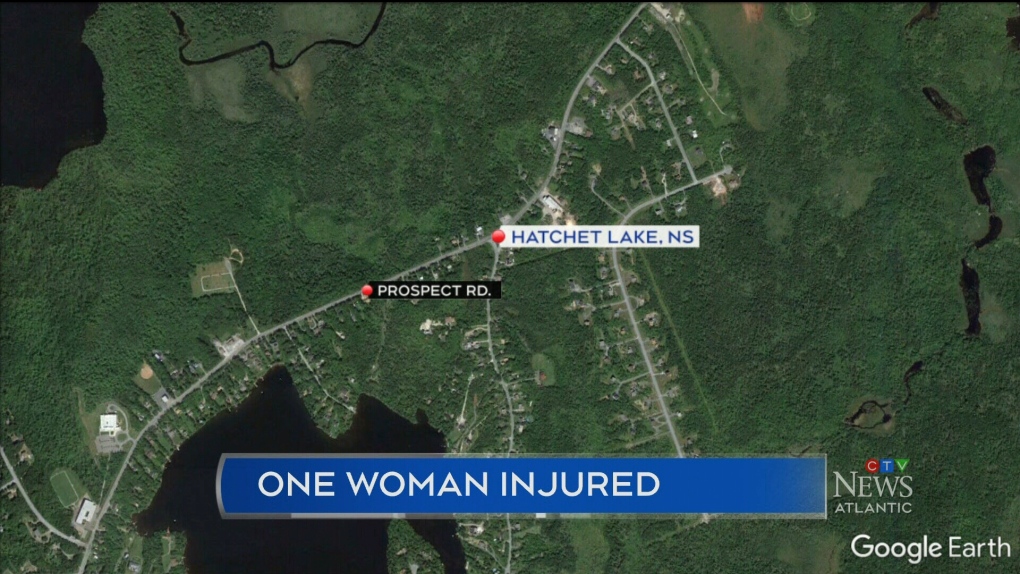 80 Year Old Woman Injured In N S Car Crash