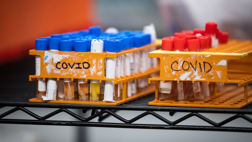 Specimens to be tested for COVID-19 are seen at LifeLabs after being logged upon receipt at the company's lab, in Surrey, B.C., on Thursday, March 26, 2020. THE CANADIAN PRESS/Darryl Dyck 